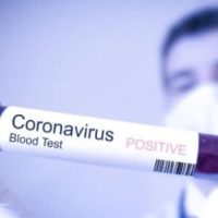 International one-time grants to entrepreneurs, small and medium-sized businesses to overcome the economic difficulties and financial losses associated with the worldwide coronavirus pandemic